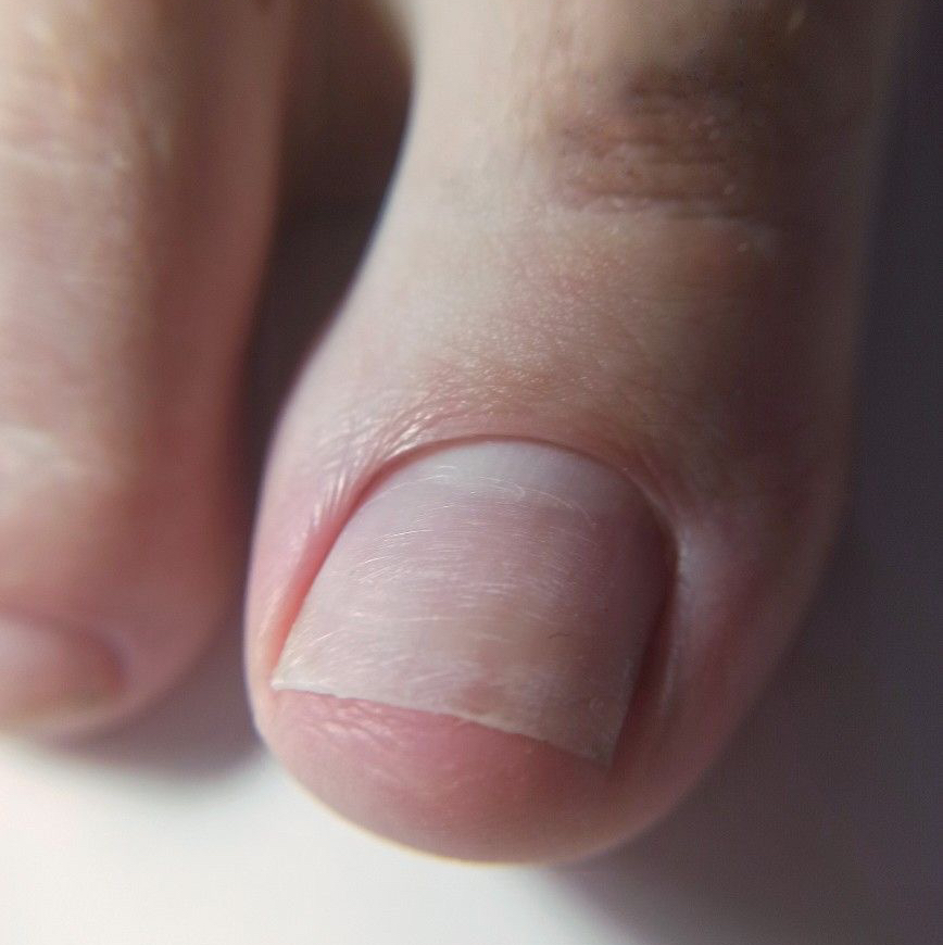 Смарт педикюр