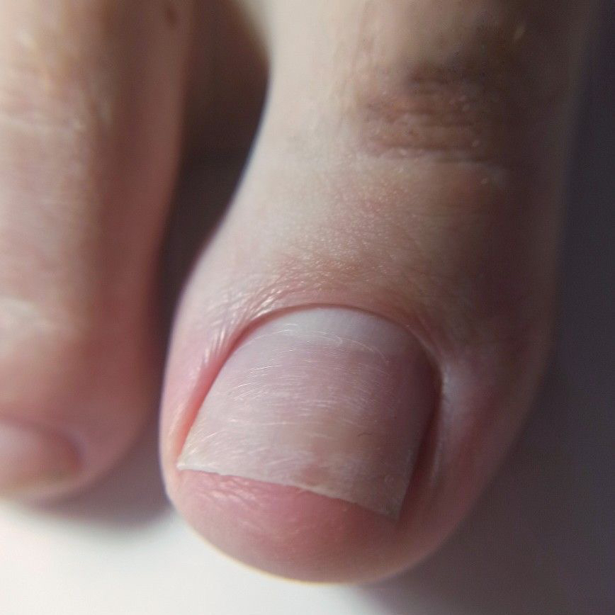 Обработка пальчиков