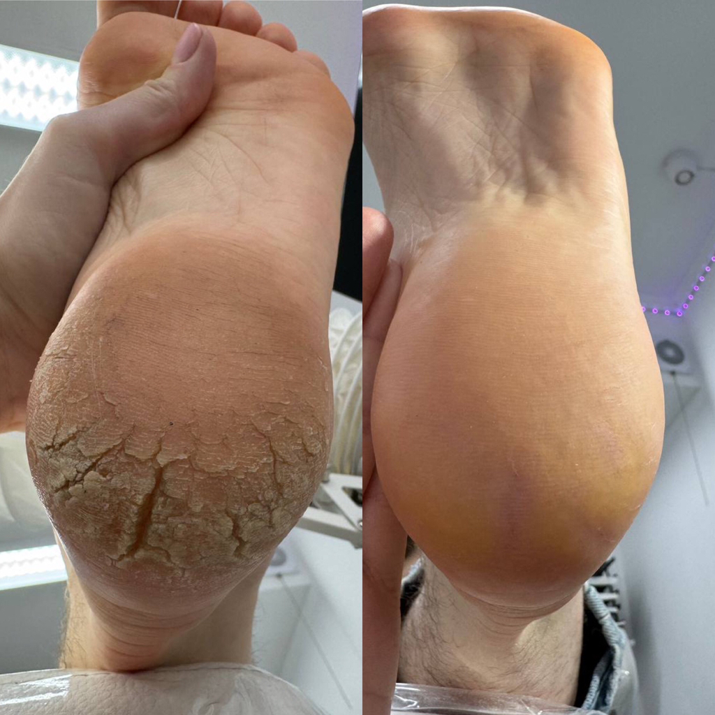 Полный педикюр без покрытия SMART