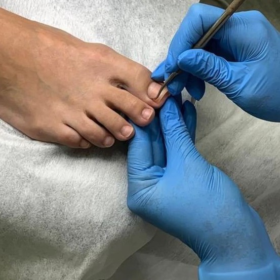 Smart-педикюр (сложные стопы)