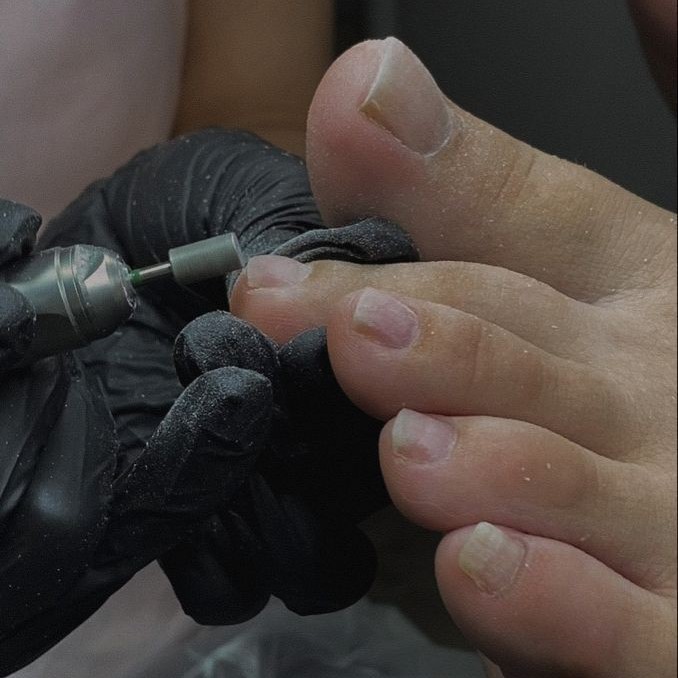 Комплекс 9. Снятие, педикюр (пальчики)