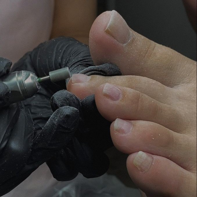 Комплекс 8. Снятие, педикюр (пальчики)