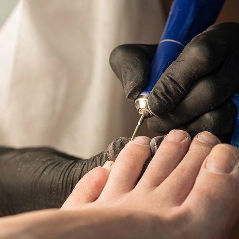 Педикюр (пальчики)