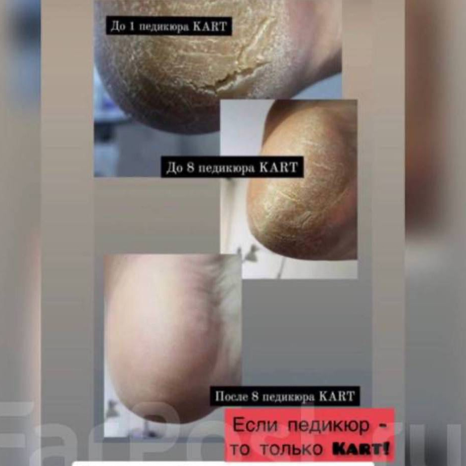 Педикюр Гигиена Карт без покрытия