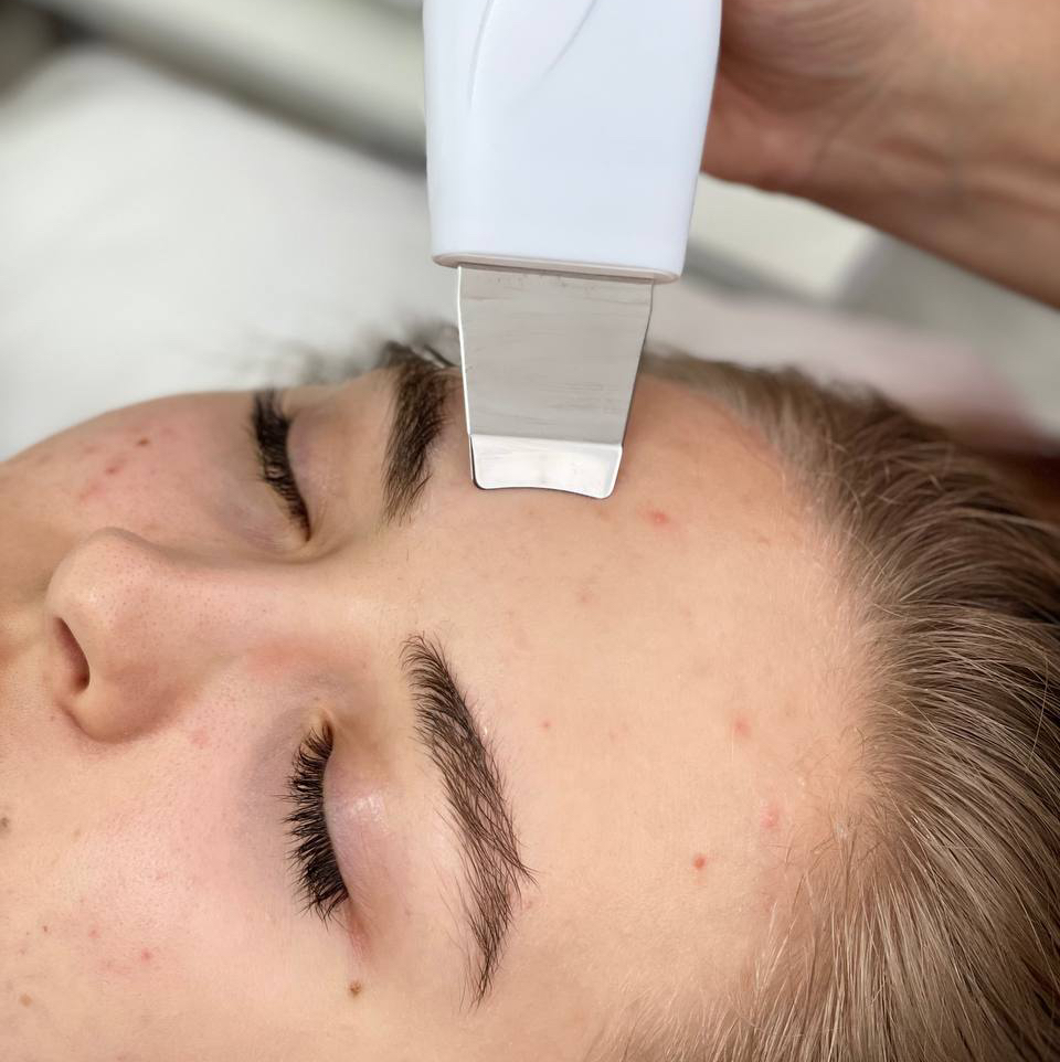 Ультразвуковая чистка