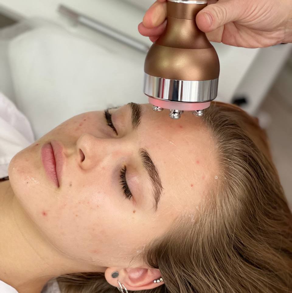 5 сеансов RF лифтинг лица