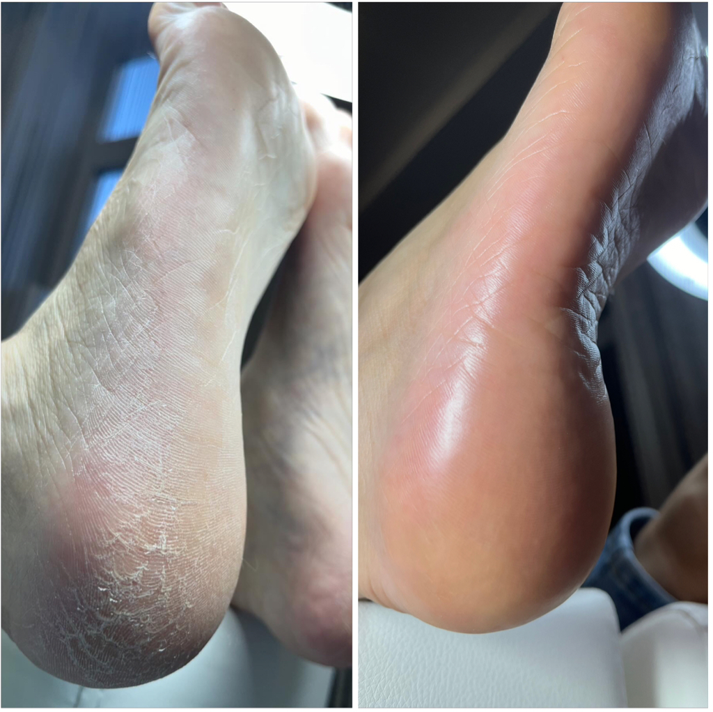 Полный педикюр без покрытия