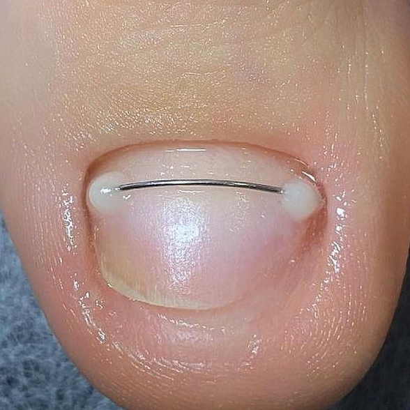 Титановая нить