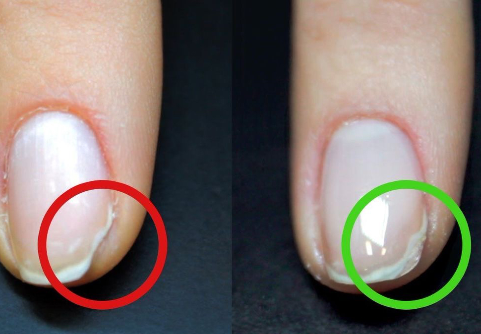 РЕМОНТ 1 НОГТЯ