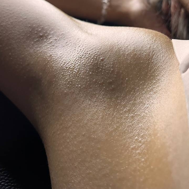 Подмышечные Впадины