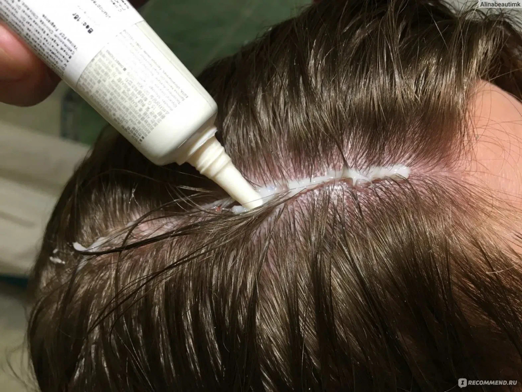 Пилинг восстановление кожи головы / Peeling restoration of the scalp