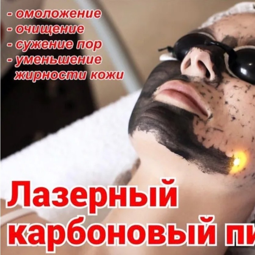 Карбоновый пилинг