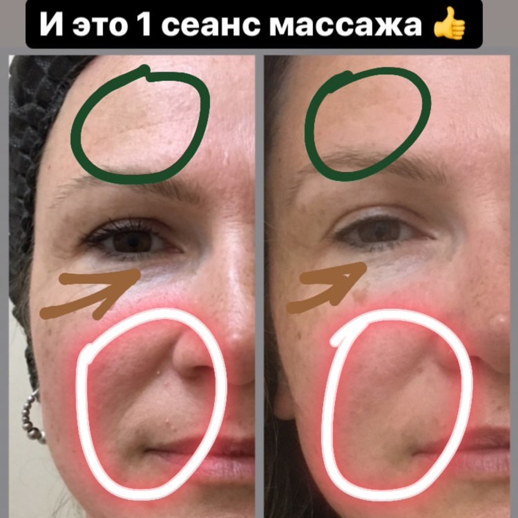 Скульптурный массаж лица