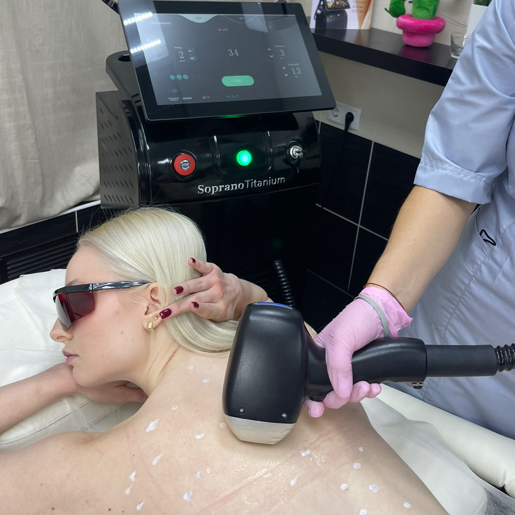 Спина - лазерная эпиляция