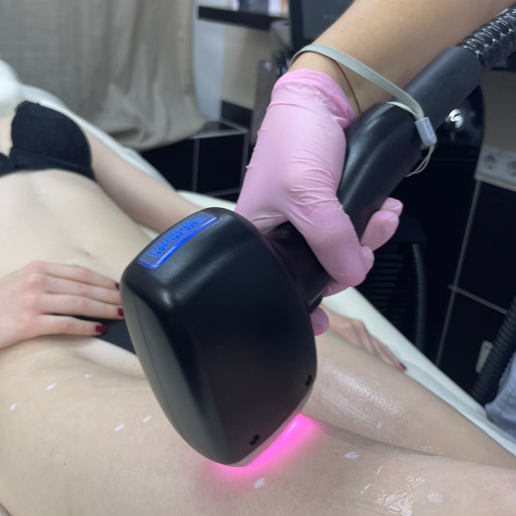 Бедра - лазерная эпиляция