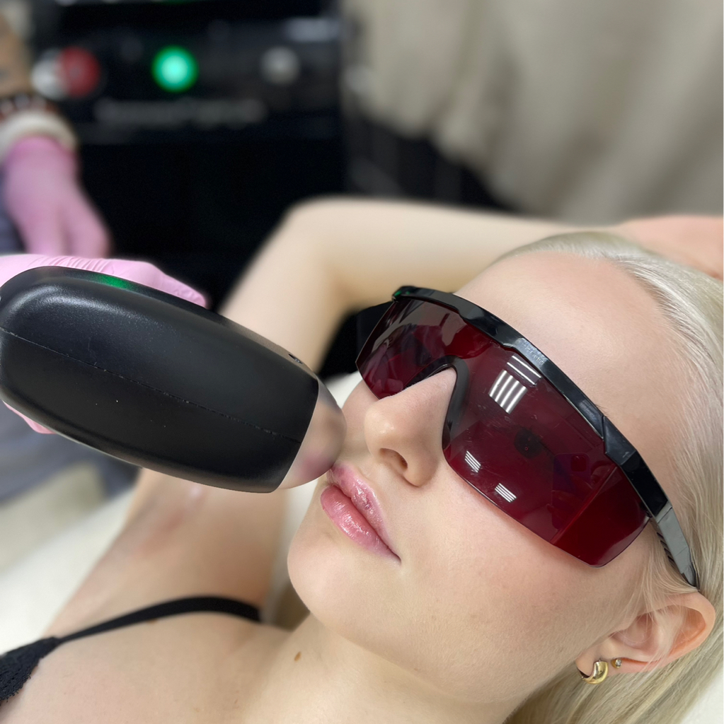 Лицо полностью - лазерная эпиляция