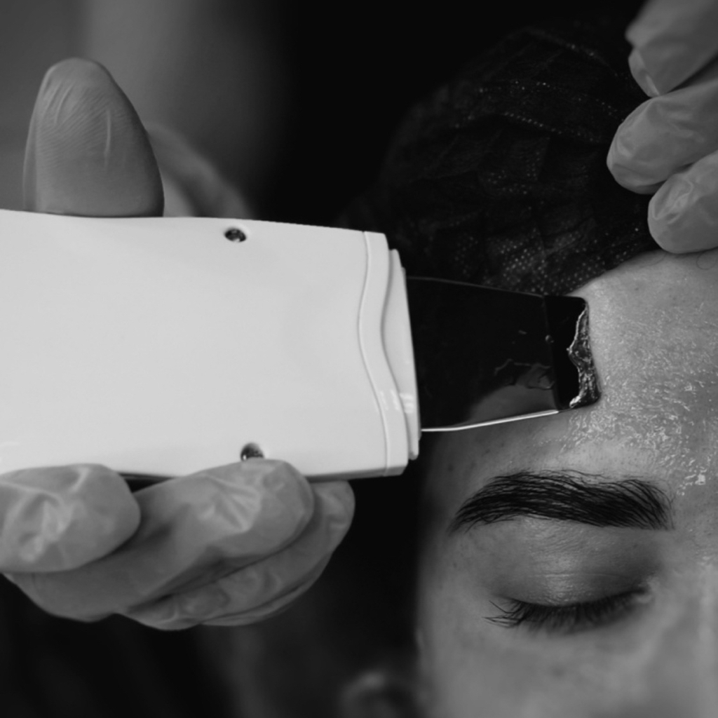 Ультразвуковая чистка лица