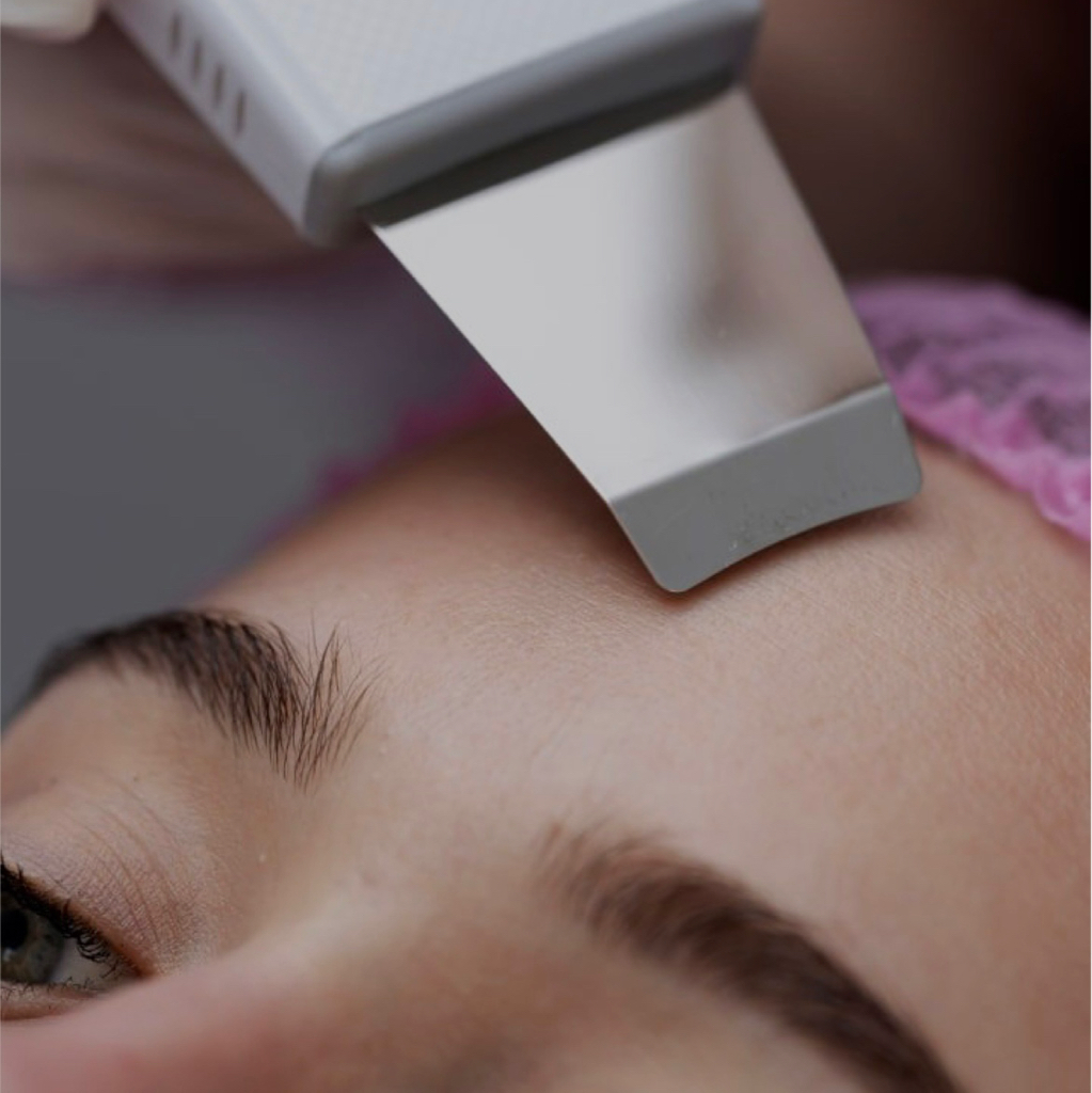 Ультразвуковая чистка + итальянский пилинг mp-systems