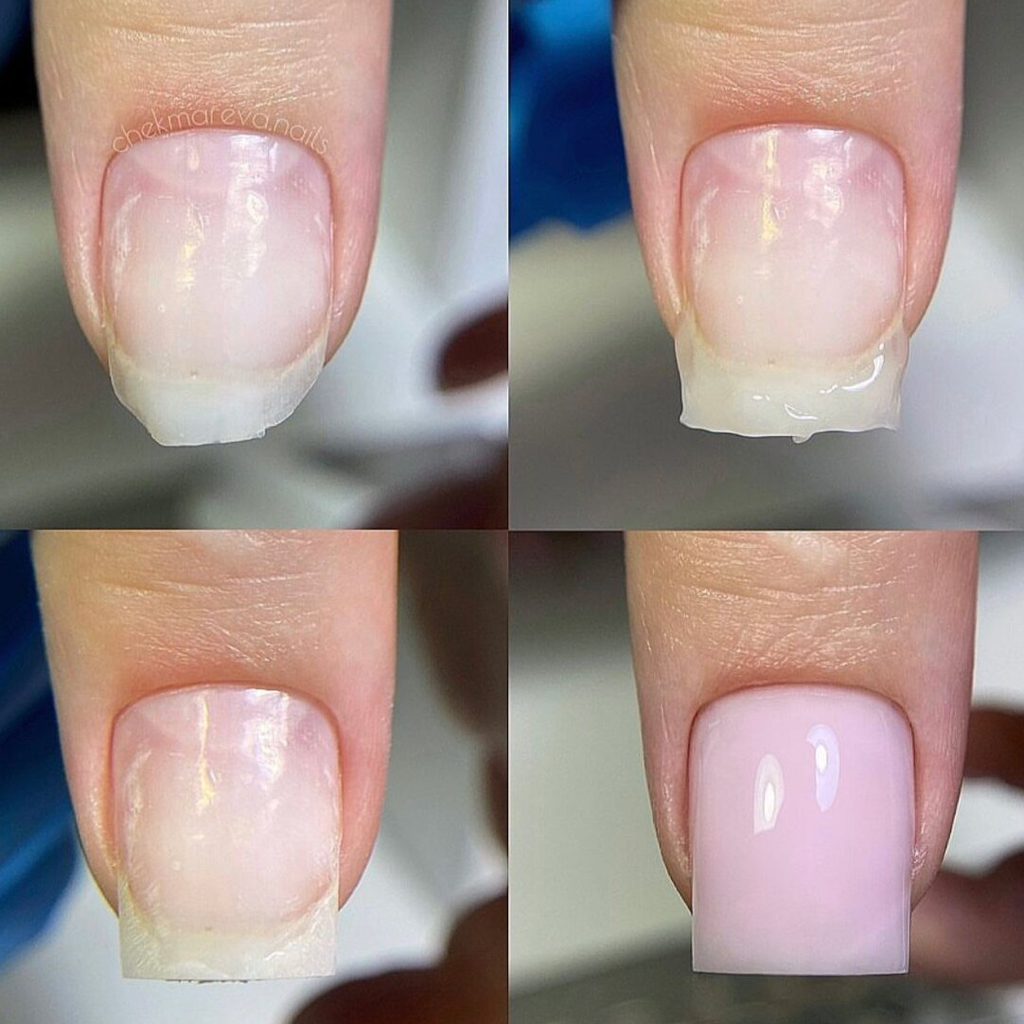 Укрепление гелем / акригелем