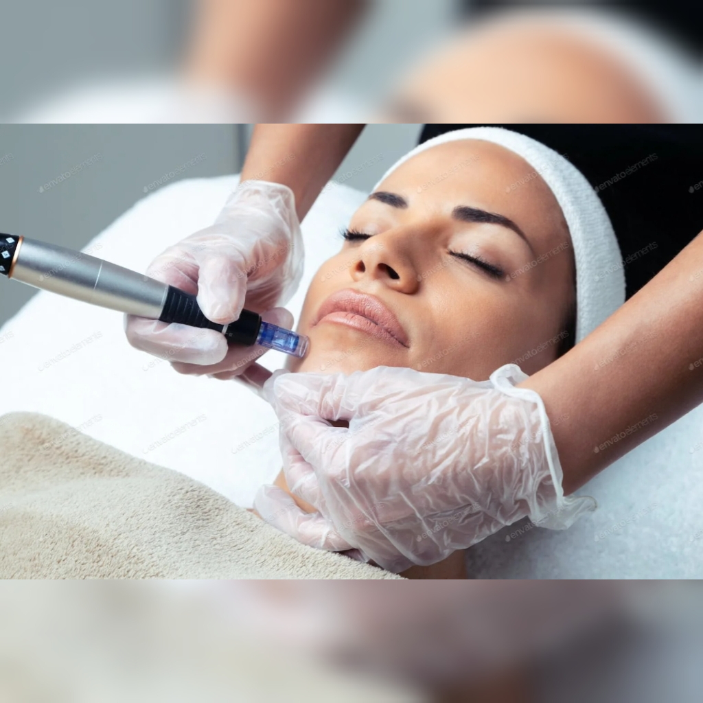 DermaPen