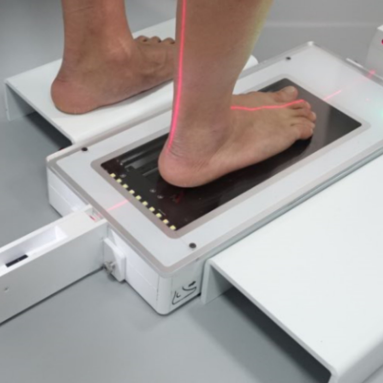 3D сканирование стоп