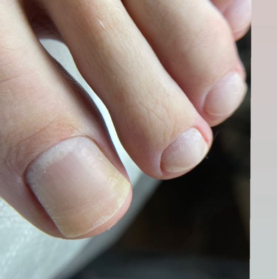 Гигиенический педикюр без покрытия только пальчики