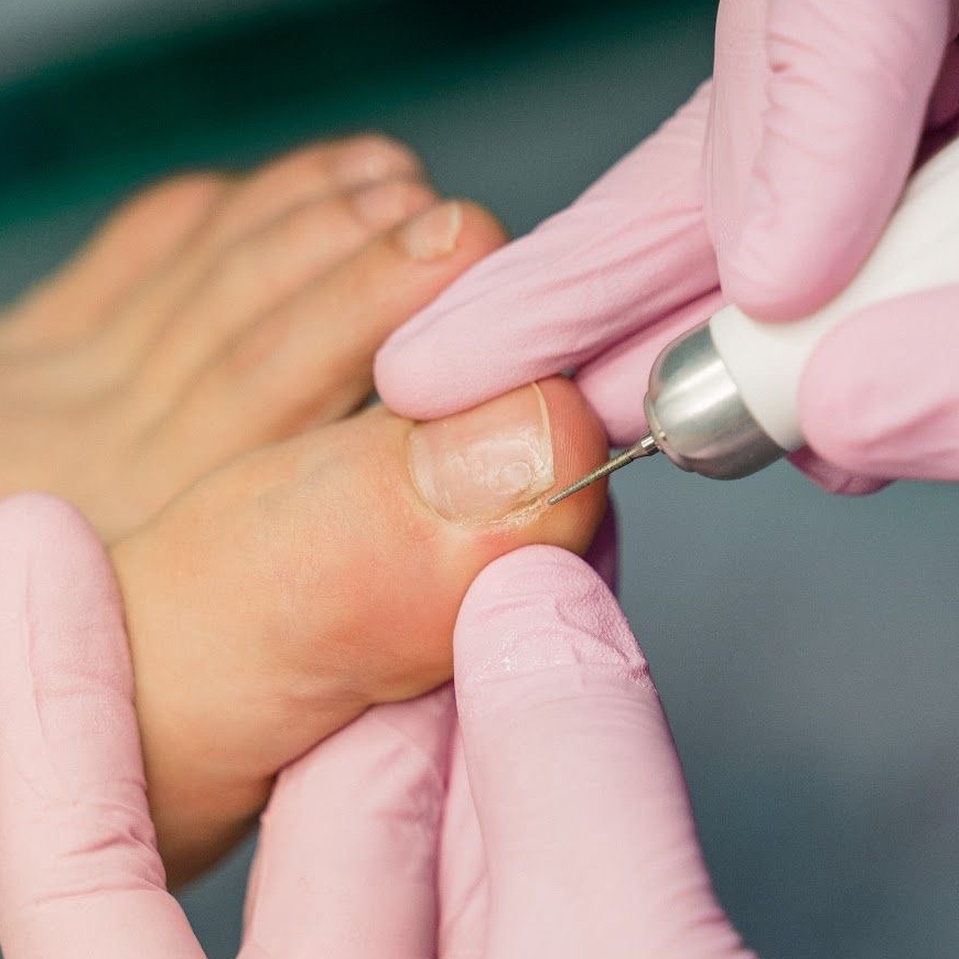 Мужской педикюр SMART (обработка пальчиков и стопы)