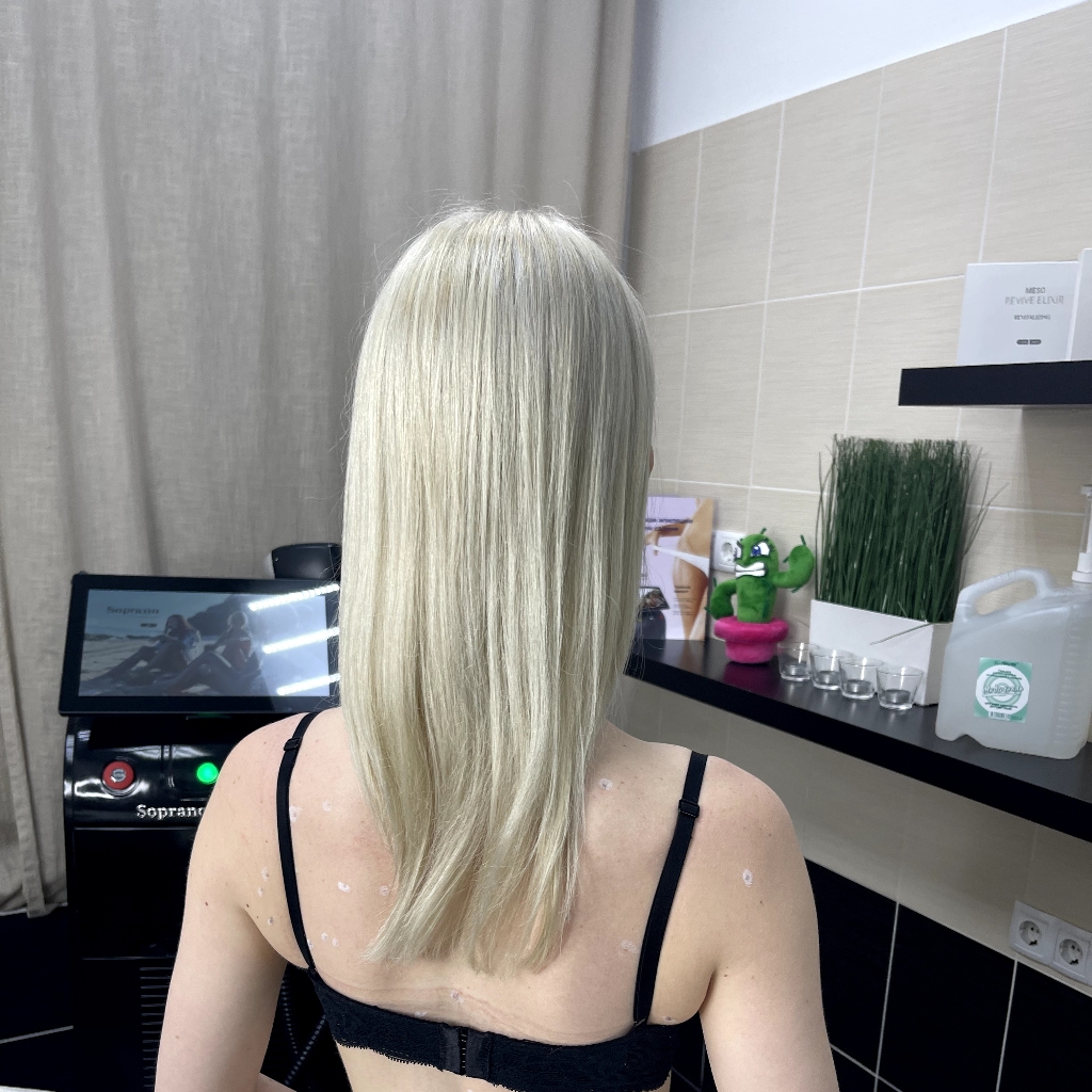 Плечи - лазерная эпиляция