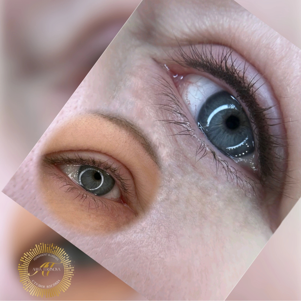 Межресничка