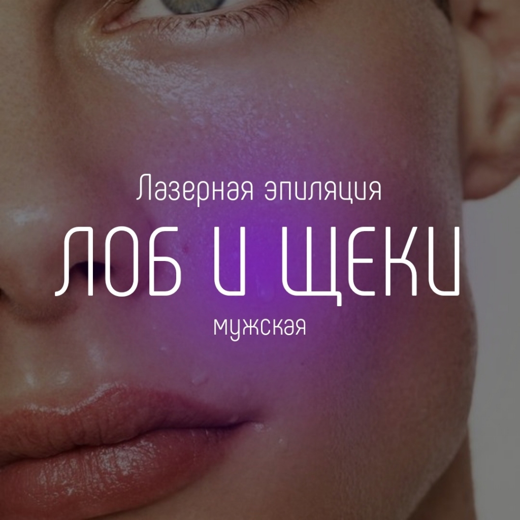 Лоб и щеки