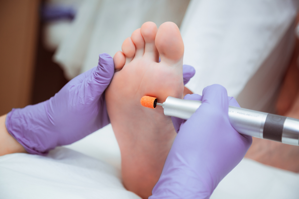 Обработка только стопы, без пальчиков