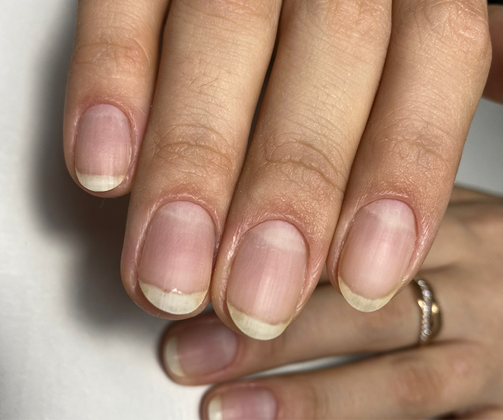 Маникюр, снятие и придание формы