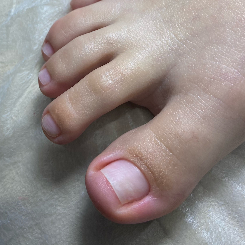 Подологический педикюр