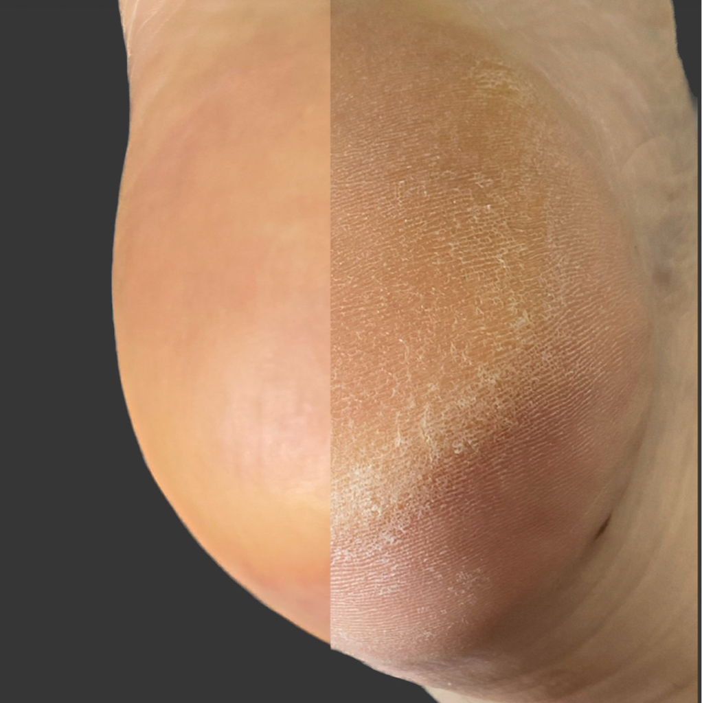 Полный педикюр