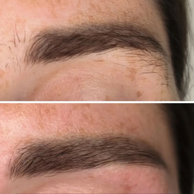 "Просто пощипать"