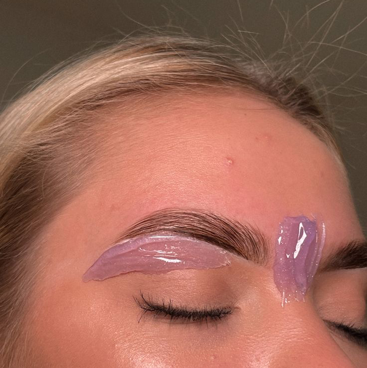 Депиляция зоны лица