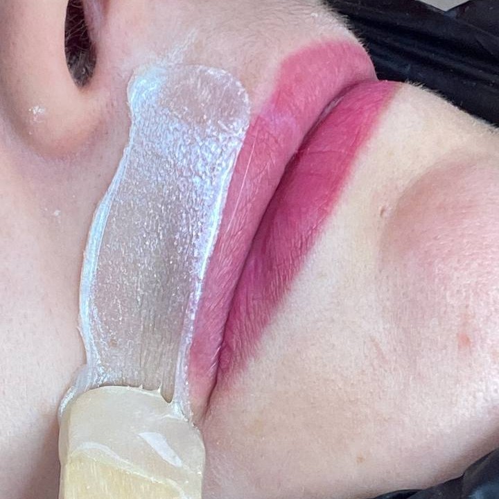 Зона над верхней губой (усики) в комплексе