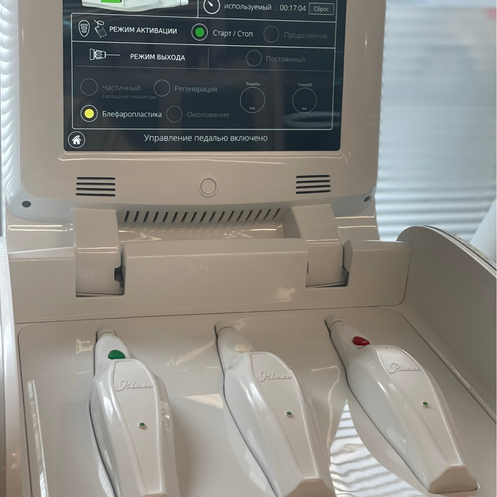 Термокоагуляция кожи (веки, рубцы, стрии, постакне, доброкачественные новообразования) PlexR Plus A20.26.006