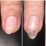 Ремонт ногтей