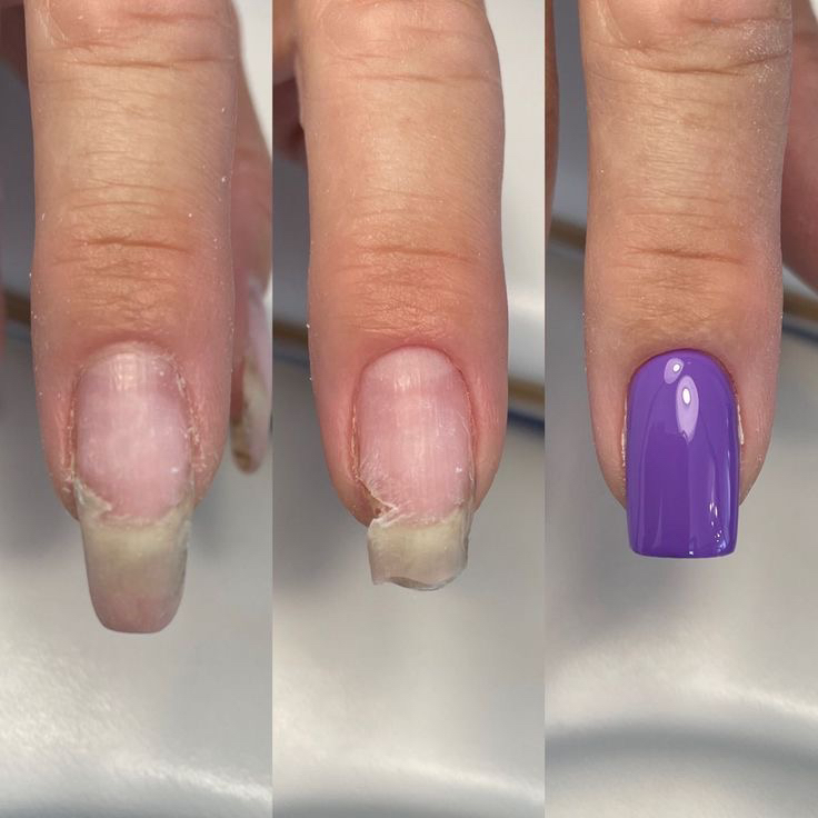 Ремонт 1 ногтя (отдельно)