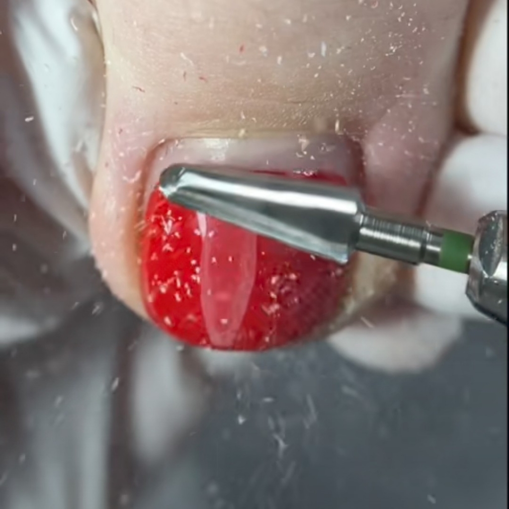 Снятие гель-лака