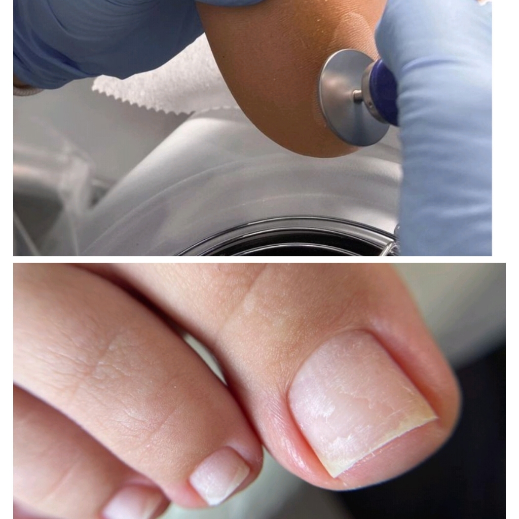 Стопы + пальчики ( с покрытием)