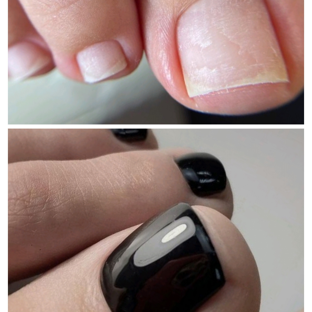 Пальчики (с покрытием)