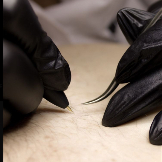 «Электроэпиляция»  Подмышечные впадины *одна зона на выбор‼️ *50₽ минута  Анастезия оплачивается отдельно 400₽