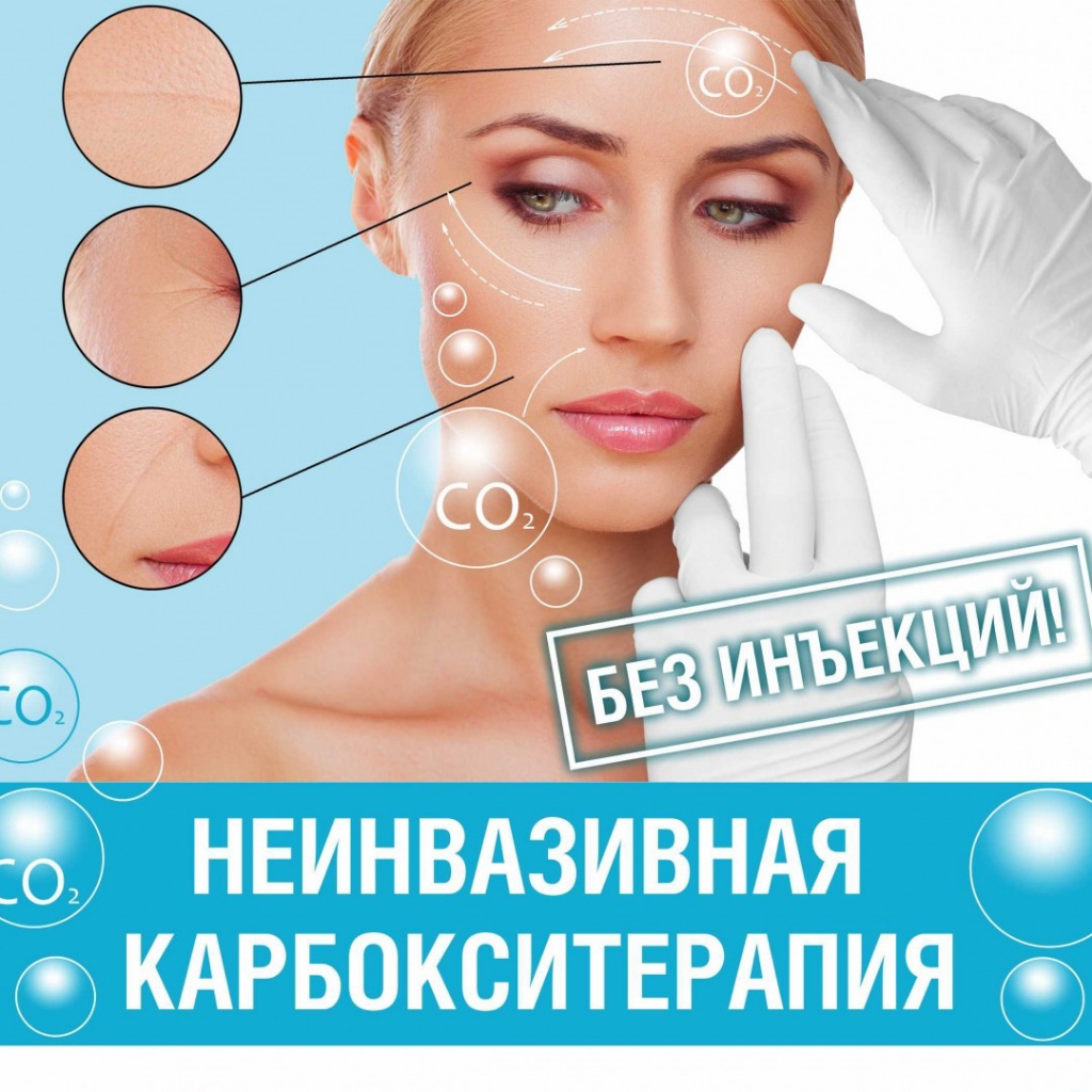 Карбокситерапия неинвазивная