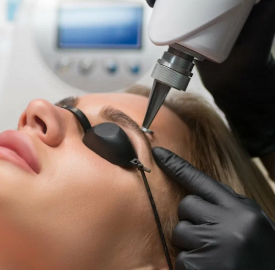 Удаление ЛАЗЕРОМ