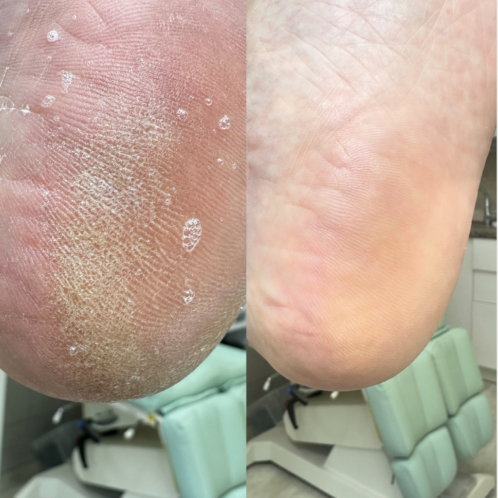 Педикюр без покрытия