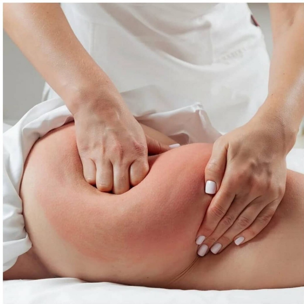 Ручной антицеллюлитный массаж (ягодицы, бёдра, икры) или (спина, руки, бока, живот)