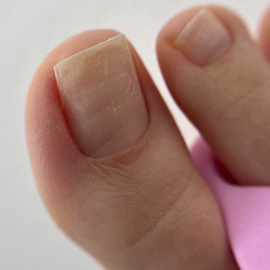 Мини педикюр/מיני פדיקור