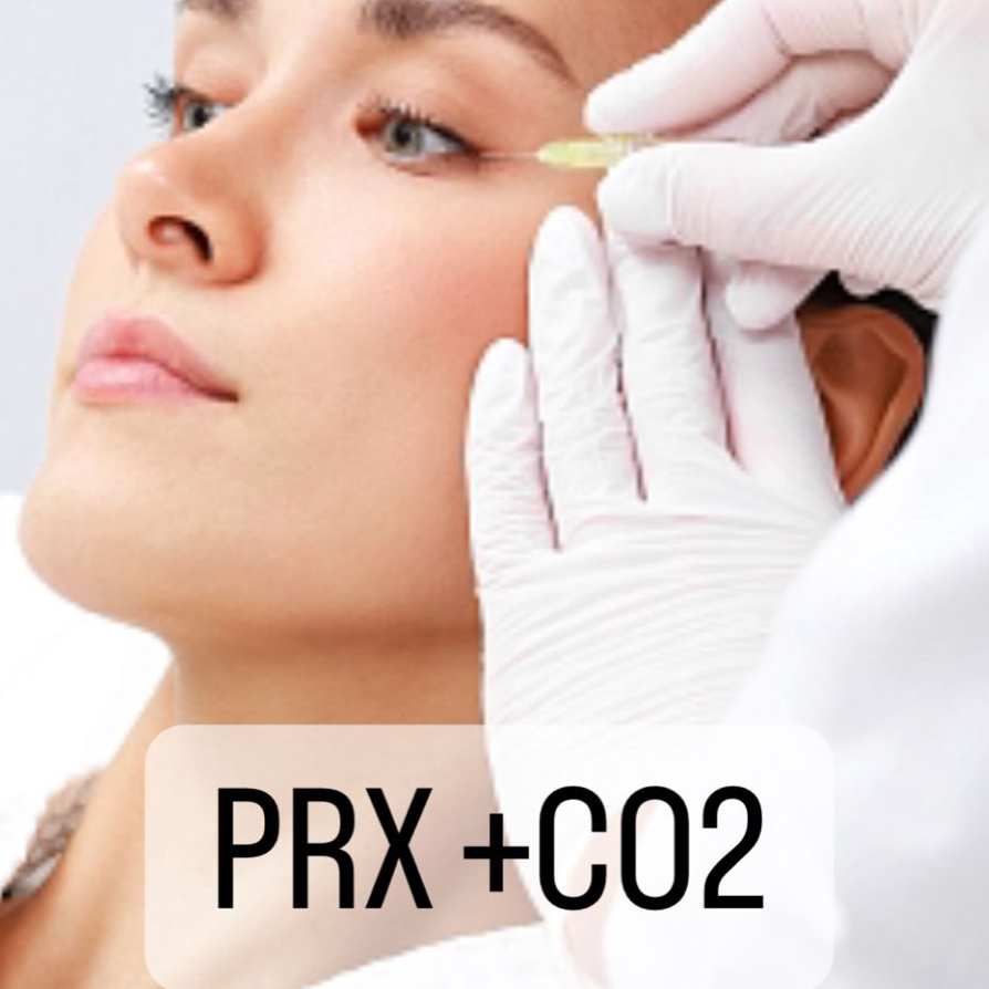 ПИЛИНГ PRX СРЕДИННЫЙ + CO2 КАРБОКСИ ТЕРАПИЯ